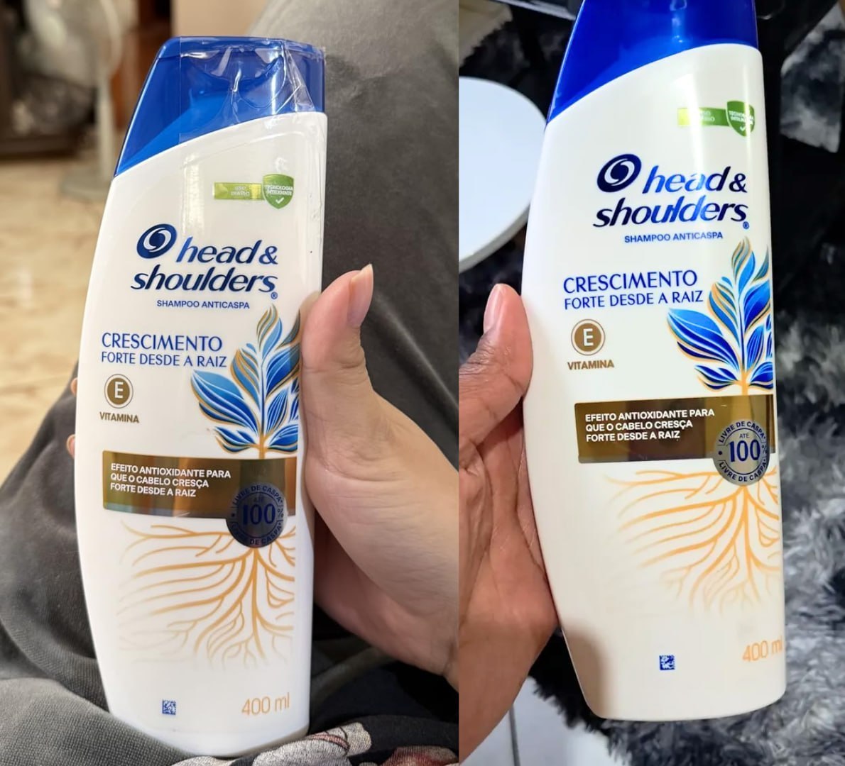 COM ESSE SHAMPOO, A CASPA VAI BATER EM RETIRADA! 😂