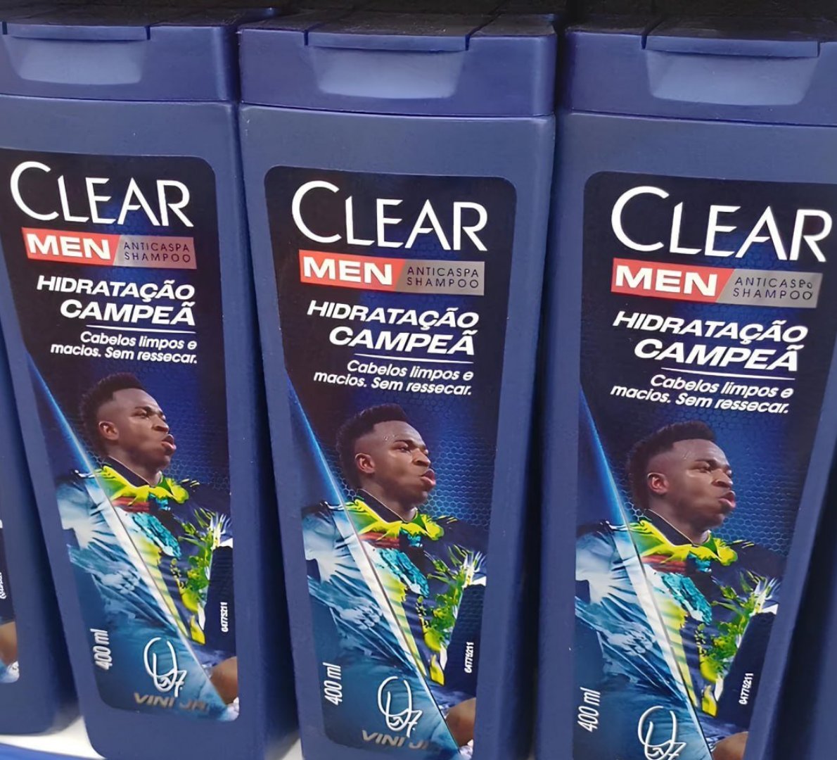 ANTICASPA DO VINI: PRA DRIBLAR ATÉ O DANDRUFF! ⚽
